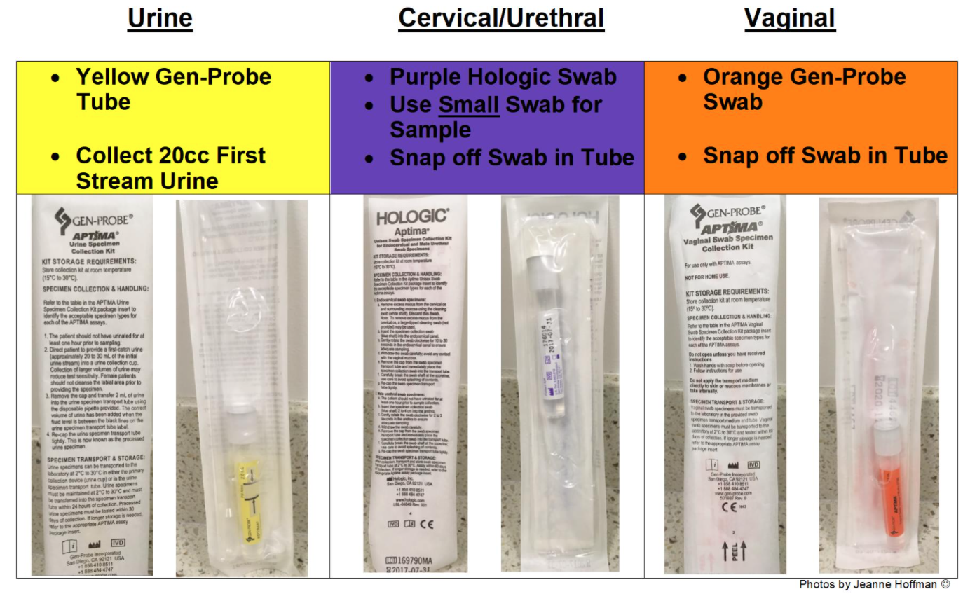 Urine Test Name For Chlamydia And Gonorrhea